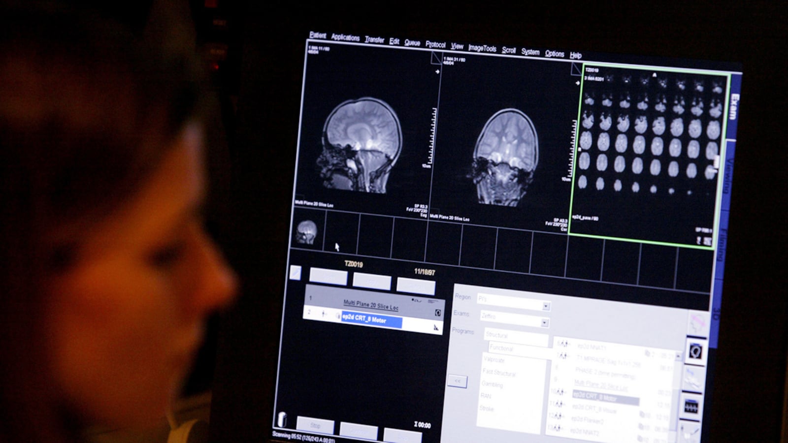 cheats/2011/08/15/study-autism-linked-to-siblings/autism-sibling-cheat_hnabif
