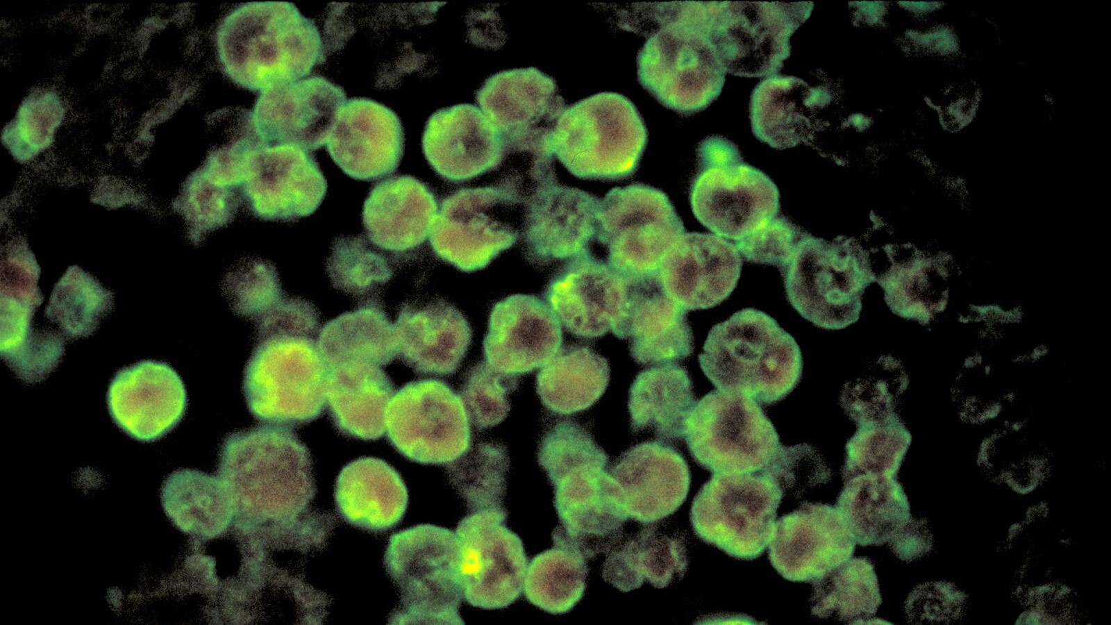 2020-09-30T204749Z_38252879_RC289J9A1SJ3_RTRMADP_3_USA-TEXAS-AMOEBA_cscbjr