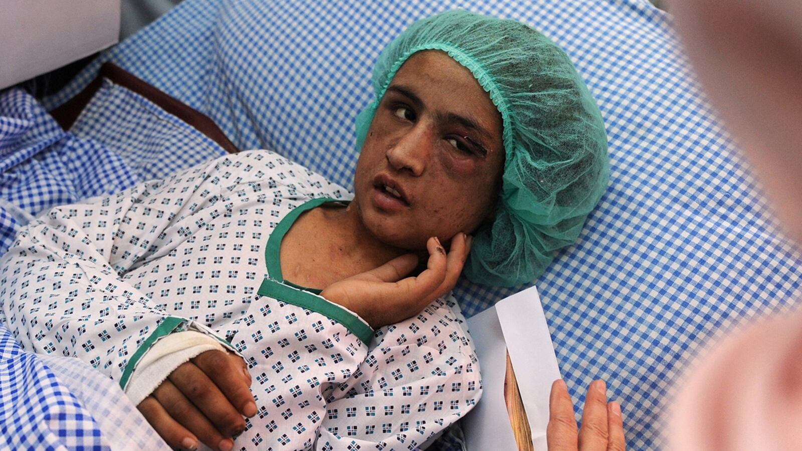 cheats/2012/01/03/3-arrested-in-torture-of-afghan-girl/sahar-gul-tortured-girl-afghanistan-cheat_ogunpg