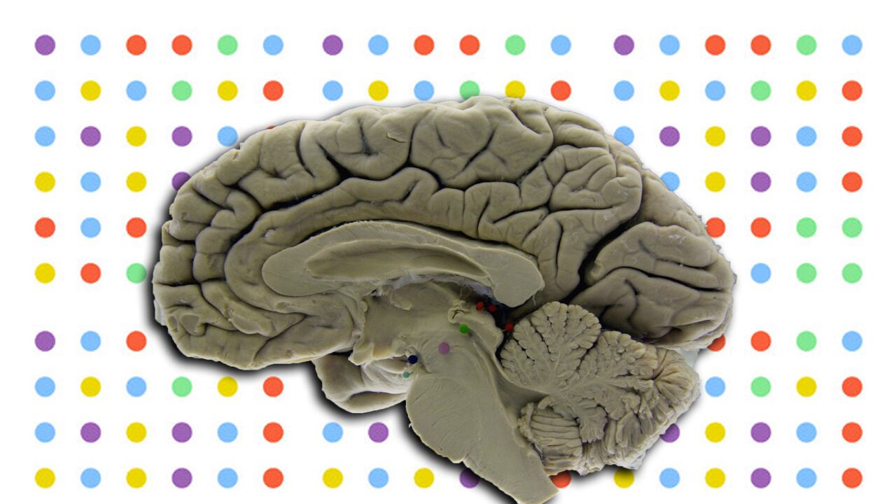 articles/2013/06/20/sorry-folks-playing-dots-won-t-make-you-smarter/130619-sepkowitz-dots-tease_onzevi