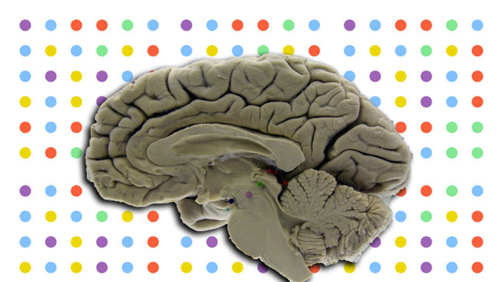 articles/2013/06/20/sorry-folks-playing-dots-won-t-make-you-smarter/130619-sepkowitz-dots-tease_onzevi