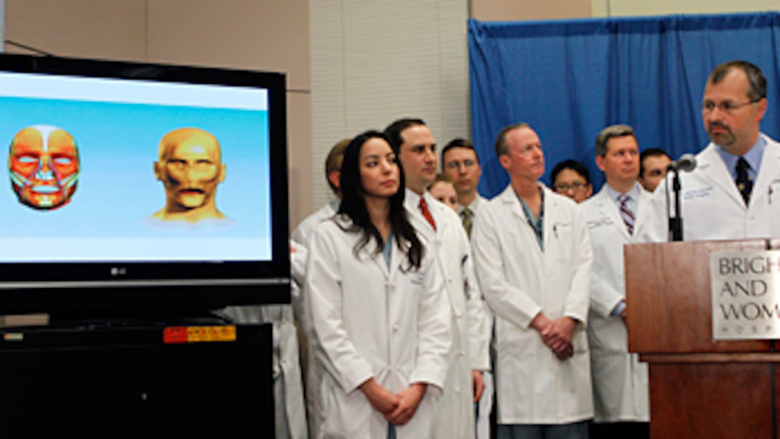 cheats/2011/03/21/first-full-face-transplant-in-us-unveiled/face-transplant-1_wuvoeg