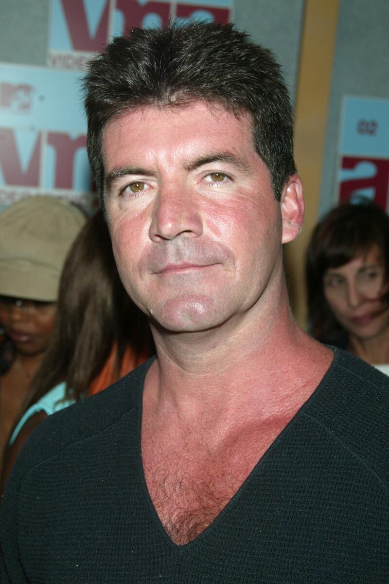 galleries/2011/07/04/celebrity-sunburns-kim-kardashian-simon-cowell-and-more/cowell-worst-celebrity-sunburns_edmmtd