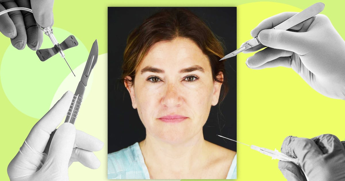 How This Woman in Her Late 40s Got Dramatic Results Without a Facelift - The Daily Beast