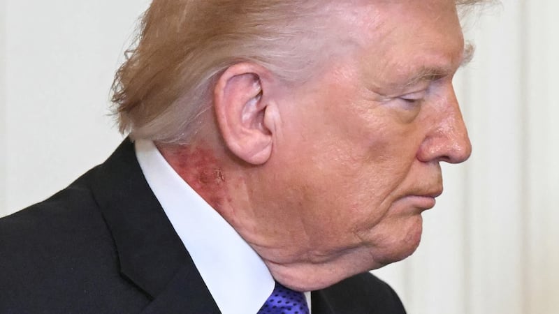 US President Donald Trump looks on during a Medal of Honor ceremony in the East Room of the White House on March 2, 2026, in Washington, DC. President Trump awarded the Medal of Honor to retired Army Command Sgt. Major Terry P. Richardson, who served in the Vietnam War, posthumously to Army Master Sgt. Roderick W. Edmonds, who served in World War II, and posthumously to Staff Sgt. Michael Ollis, who died in combat in Afghanistan in 2013. (Photo by SAUL LOEB / AFP via Getty Images)