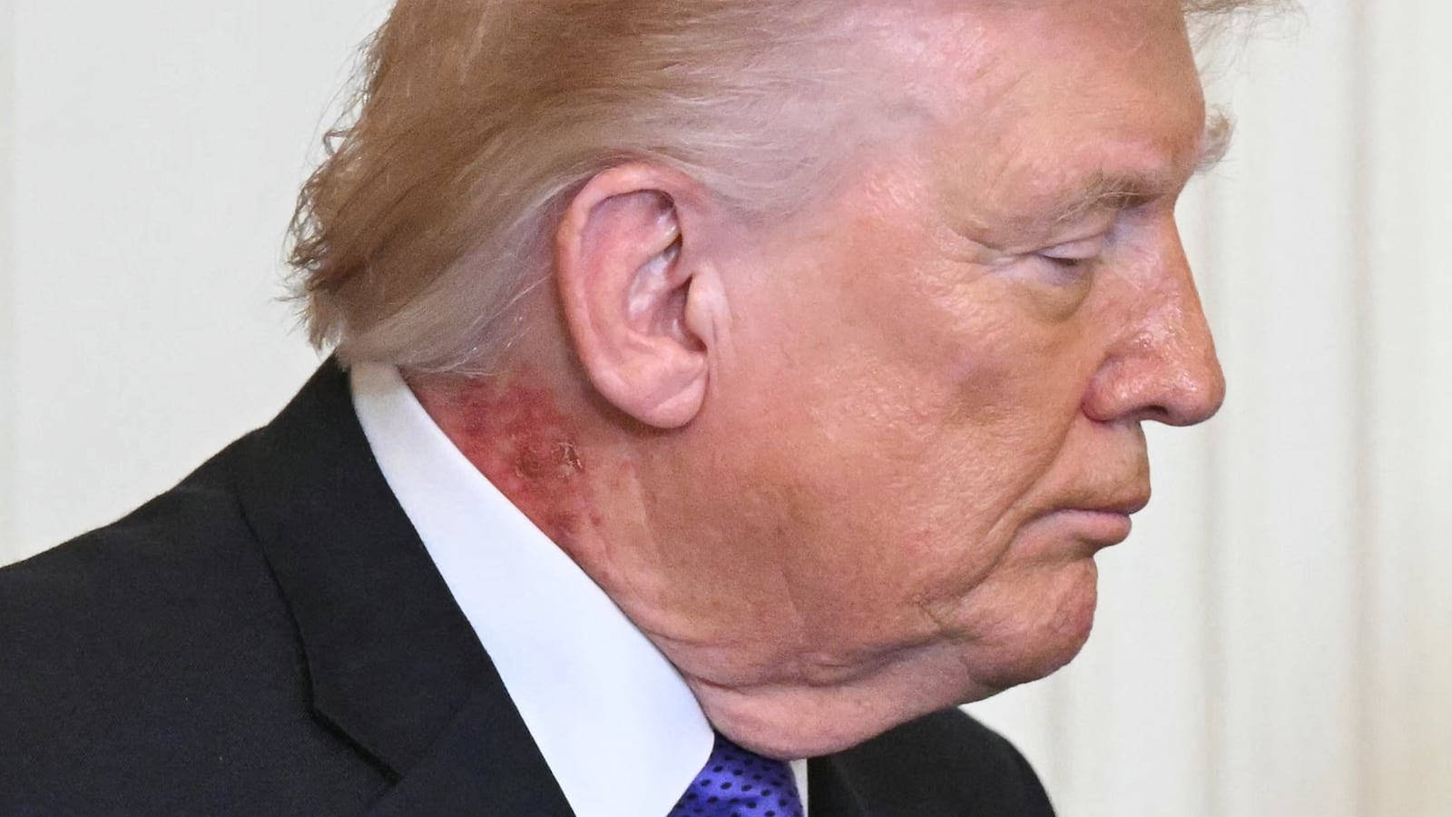 US President Donald Trump looks on during a Medal of Honor ceremony in the East Room of the White House on March 2, 2026, in Washington, DC. President Trump awarded the Medal of Honor to retired Army Command Sgt. Major Terry P. Richardson, who served in the Vietnam War, posthumously to Army Master Sgt. Roderick W. Edmonds, who served in World War II, and posthumously to Staff Sgt. Michael Ollis, who died in combat in Afghanistan in 2013. (Photo by SAUL LOEB / AFP via Getty Images)