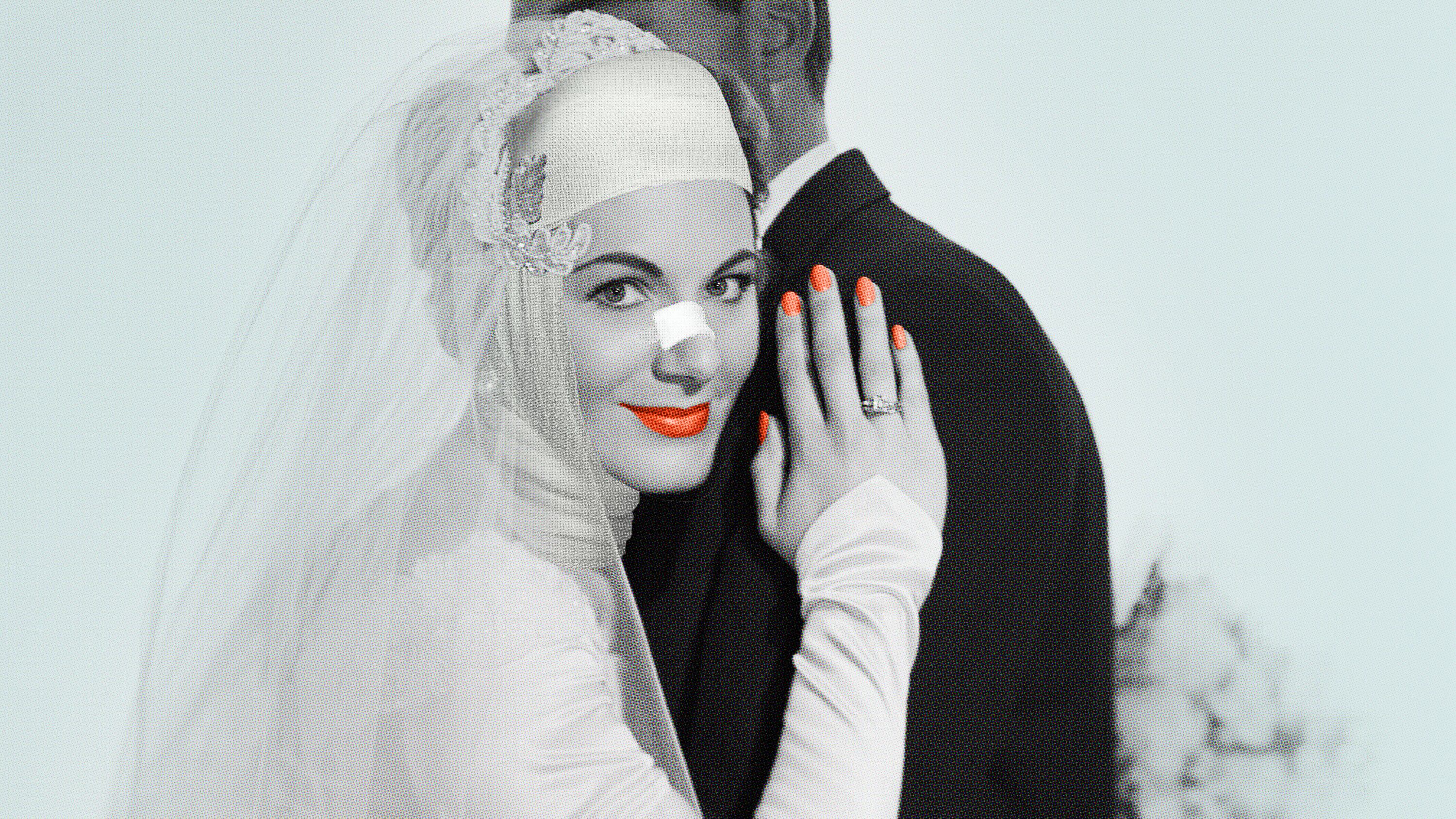 Bride with nose and head bandage