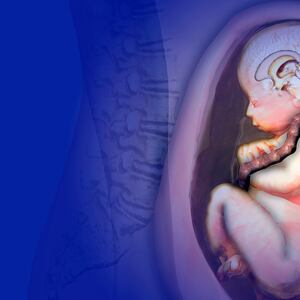 171108-Watts-Spina-Bifida-tease_kg4gsl