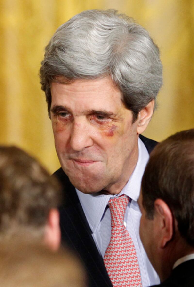 galleries/2012/06/13/stars-with-shiners-lady-gaga-reese-witherspoon-robert-downey-jr-madonna-others/kerry-stars-with-shiners_ompje2