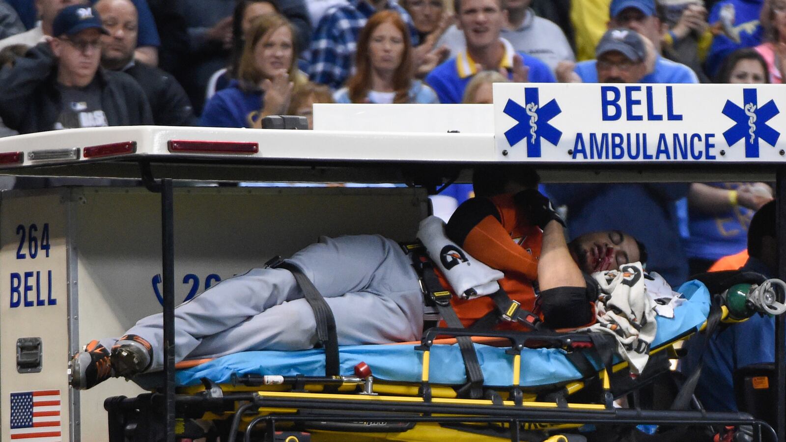 cheats/2014/09/12/marlins-hitter-suffers-facial-fractures/140912-marlins-injury-cheat_vip2qd