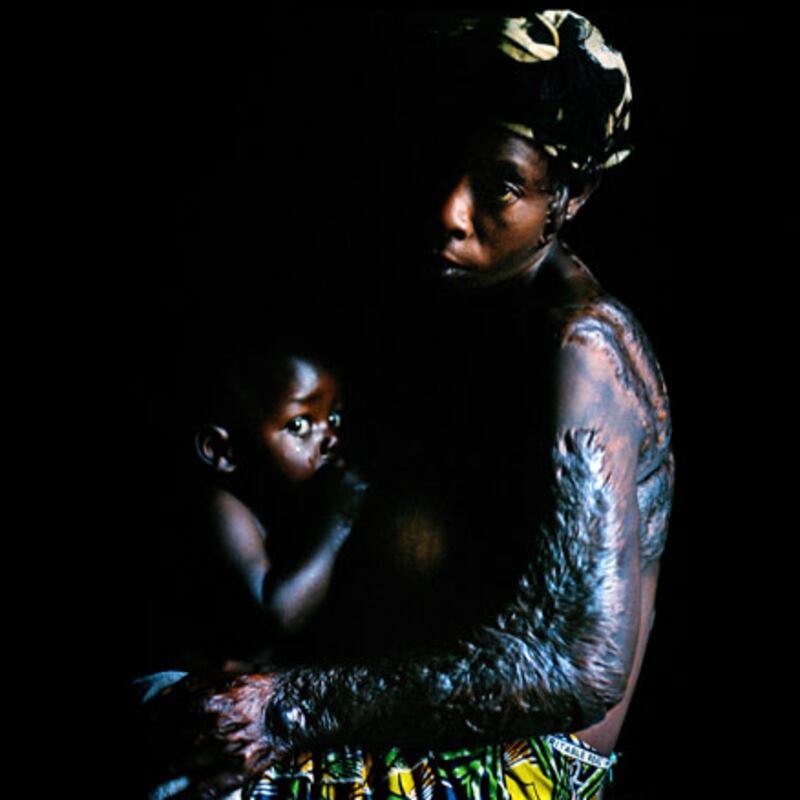 galleries/2010/06/08/congo-s-resilient-rape-survivors/congo-rape-as-weapon-1_mpap11