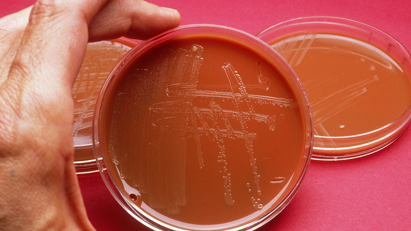 articles/2013/05/07/drug-resistant-gonorrhea-the-sex-superbug-is-not-worse-than-aids/130506-Sepkowitz-Gonorrhea-tease_jqiea0