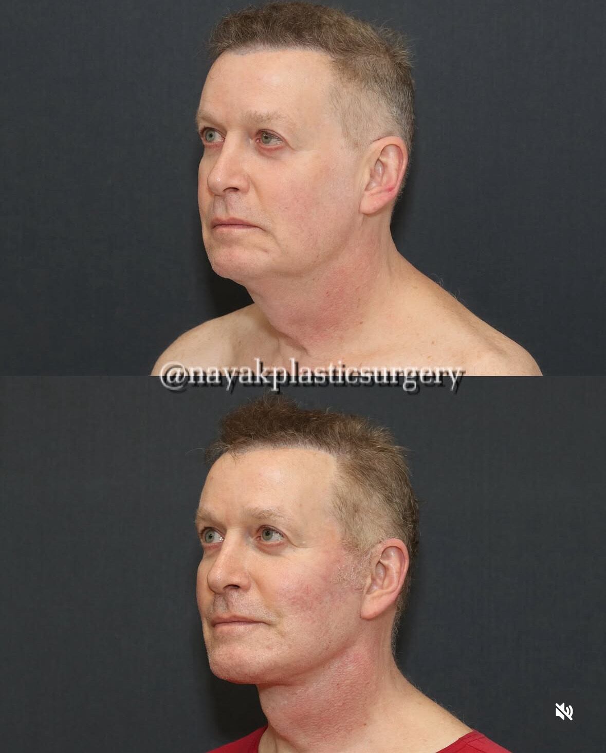 John Spaedy before-and-after photos.