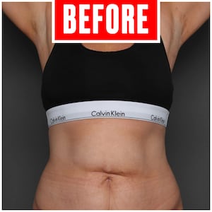 Body Transformation before image
