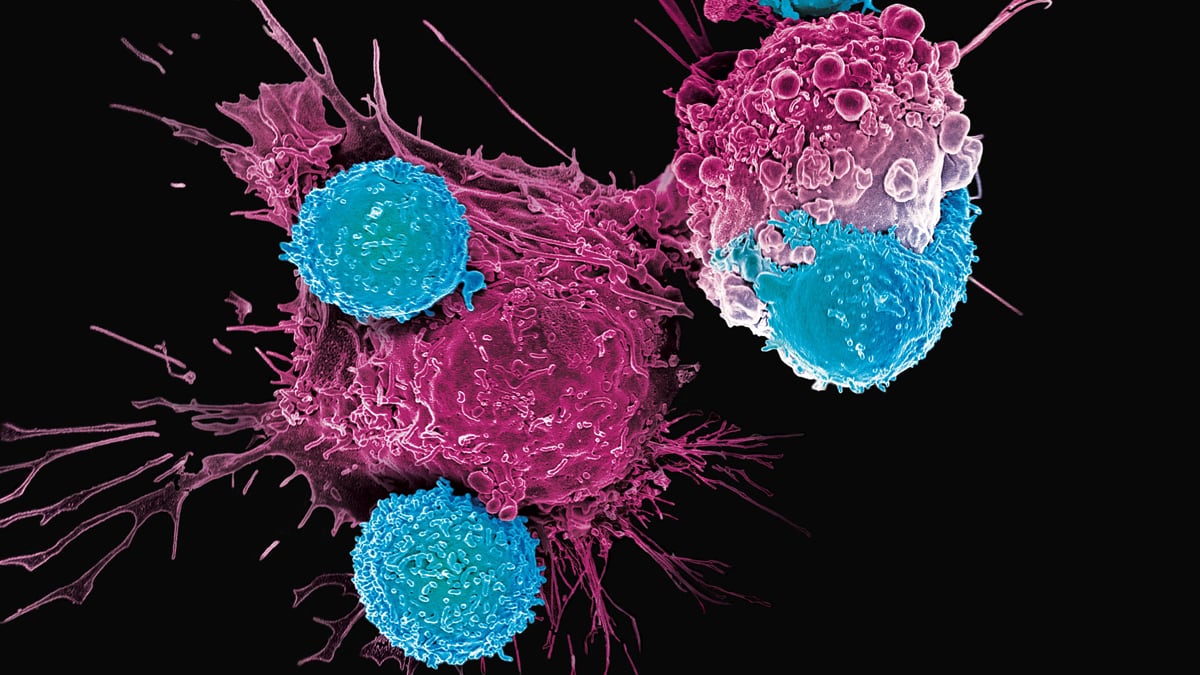 T cells attacking cancer cells.