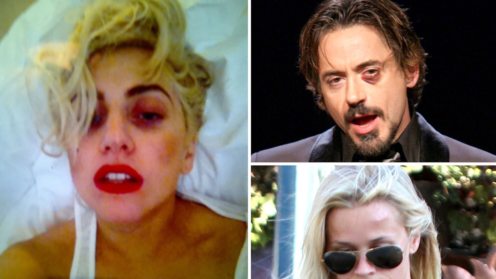 galleries/2012/06/13/stars-with-shiners-lady-gaga-reese-witherspoon-robert-downey-jr-madonna-others/stars-with-shiners-tease_ryruab
