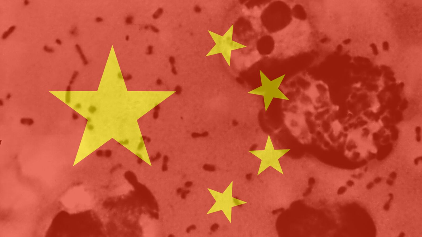 articles/2014/07/23/it-s-not-time-to-worry-about-china-s-plague-just-yet/140723-china-plague-sepkowitz-tease_j4pure