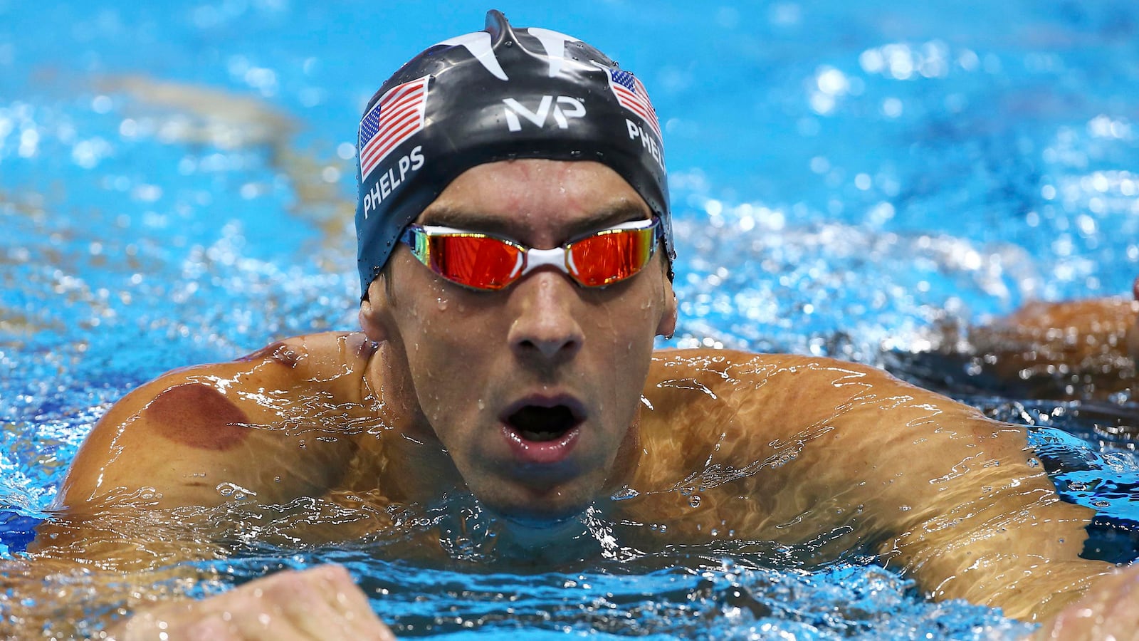 articles/2016/08/08/those-bruises-on-olympians-are-from-cupping-but-what-is-cupping/160808-slattery-cupping-tease_mpcjre