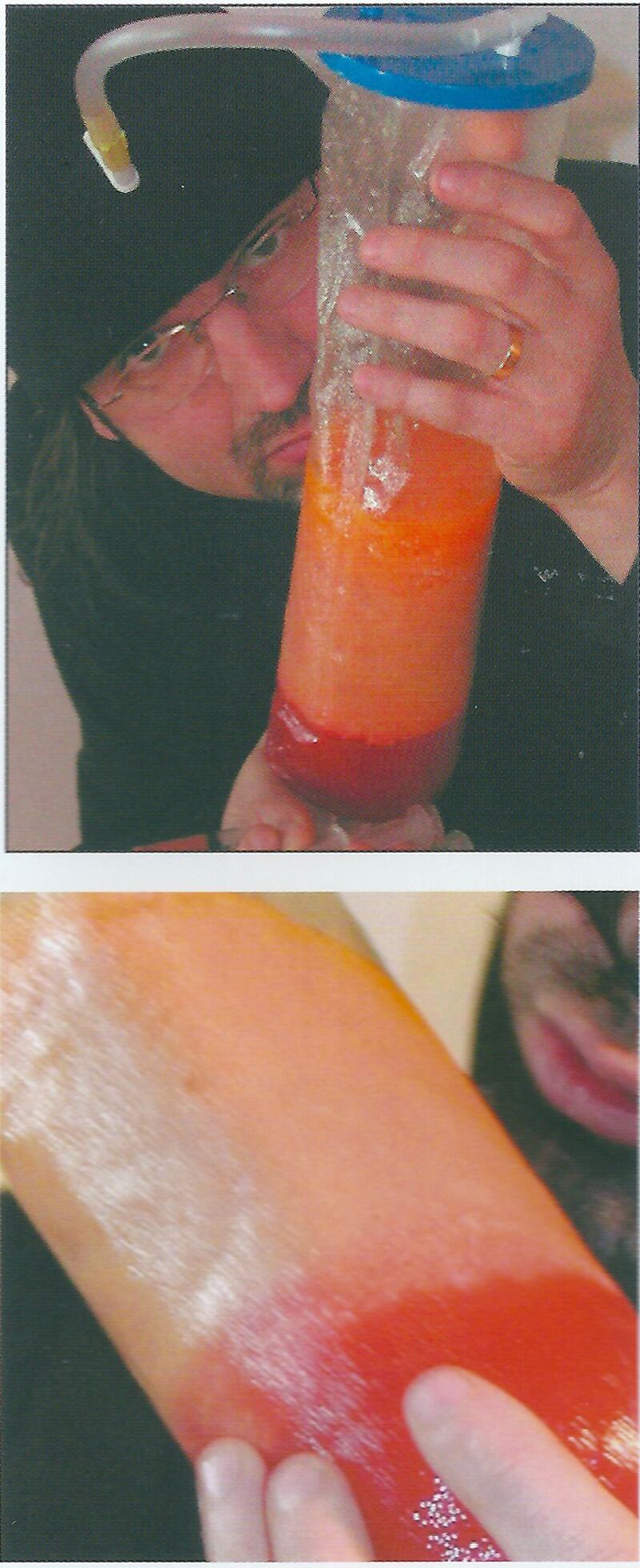 articles/2015/07/15/meet-the-artist-who-paints-with-liposuction-fat/150714-foreman-liposuction-embed1_qbvmhv