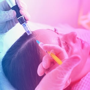 Exosome Hair Loss Treatments