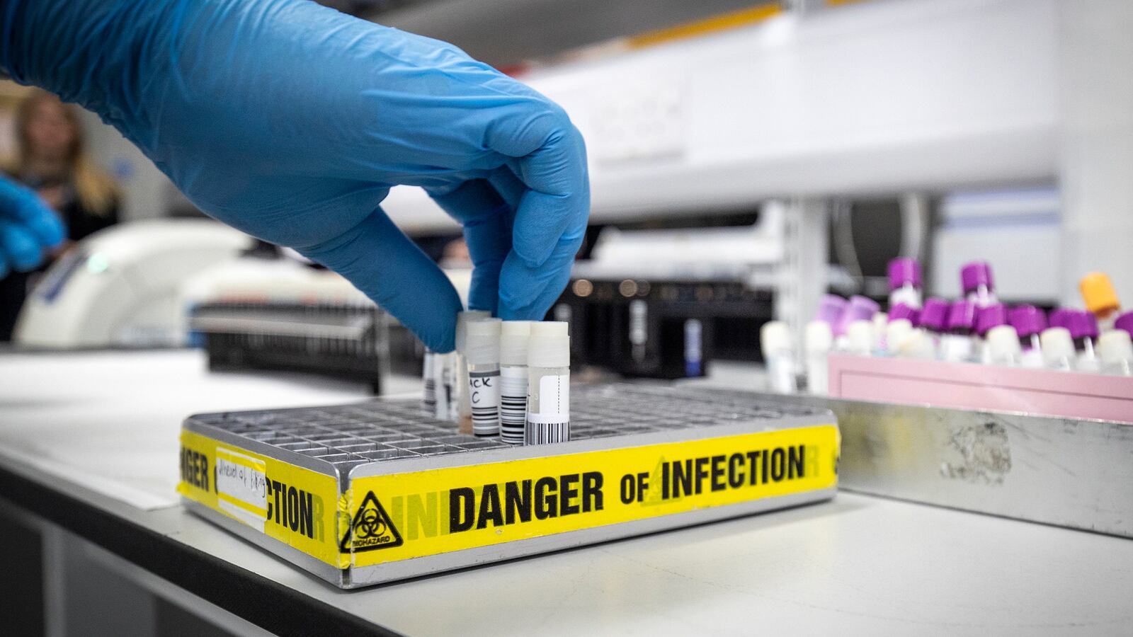 200227-Messer-Coronavirus-Testing-Worse-tease_nll5su