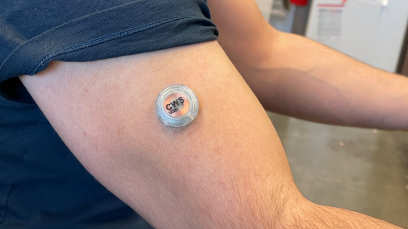 multi-tasking-microneedle-wearable-1_g4ex3o