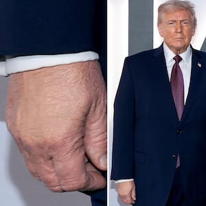 A close-up of Donald Trump's hand at the "Melania" premiere.
