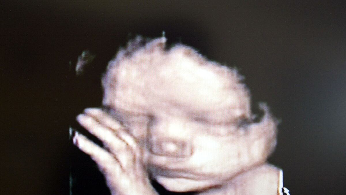 articles/2012/06/08/new-finding-that-testing-could-identify-defects-in-fetuses-is-a-genetics-baby-step/fetus-ultrasound-sepkowitz_oavrym