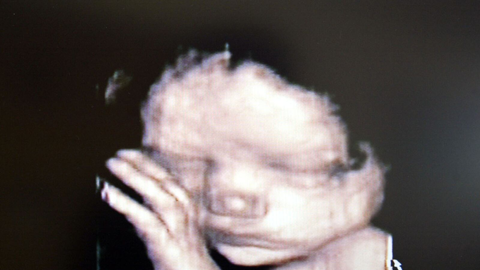 articles/2012/06/08/new-finding-that-testing-could-identify-defects-in-fetuses-is-a-genetics-baby-step/fetus-ultrasound-sepkowitz_oavrym