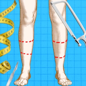 A photo illo illustration for The Looker of legs and surgical tools.