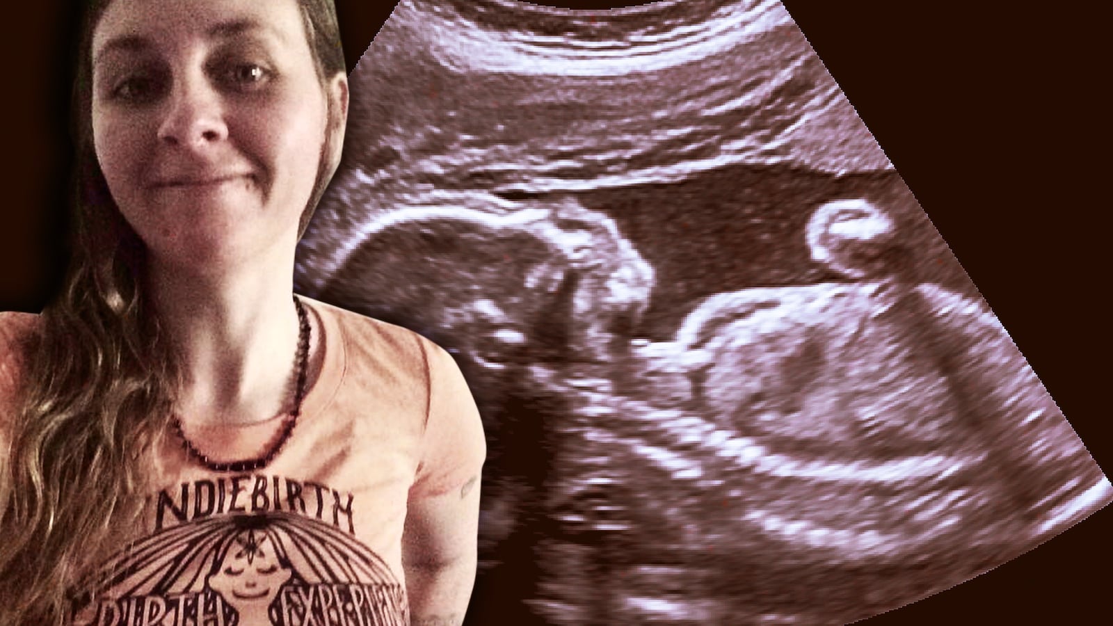 190722-weil-midwife-miscarrige-tease_g0xx7v