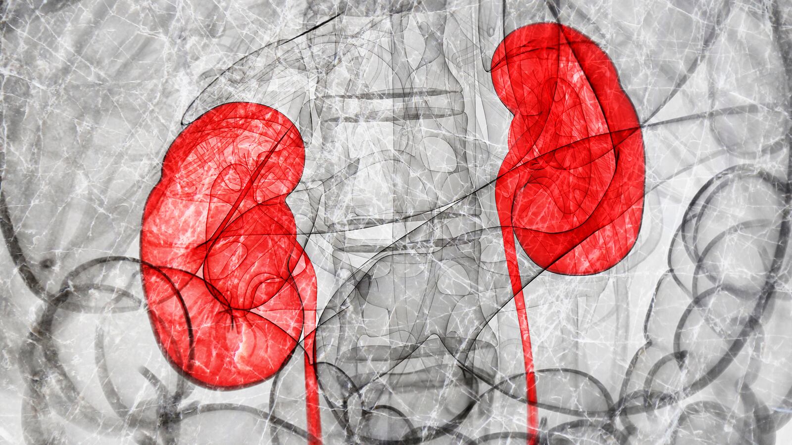 220124-kidneys-race-tease-01_sz8krr