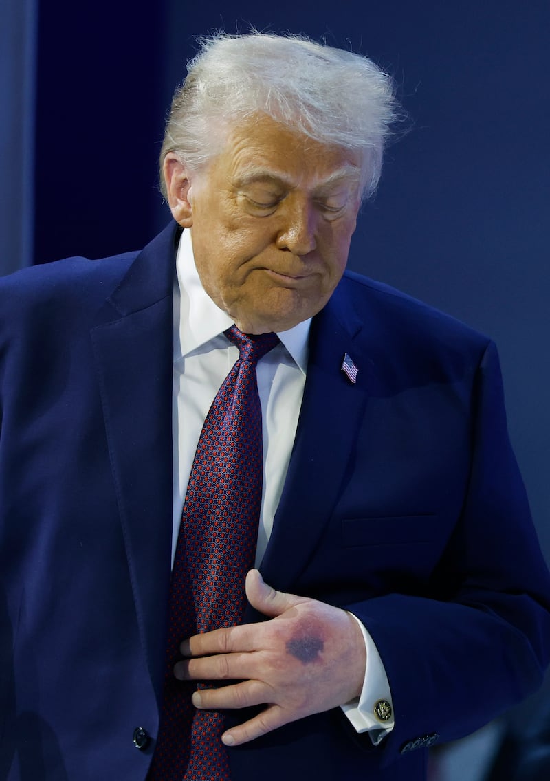 President Donald Trump looks on after holding a signing ceremony for the “Board of Peace” at the World Economic Forum (WEF) on January 22, 2026 in Davos, Switzerland.