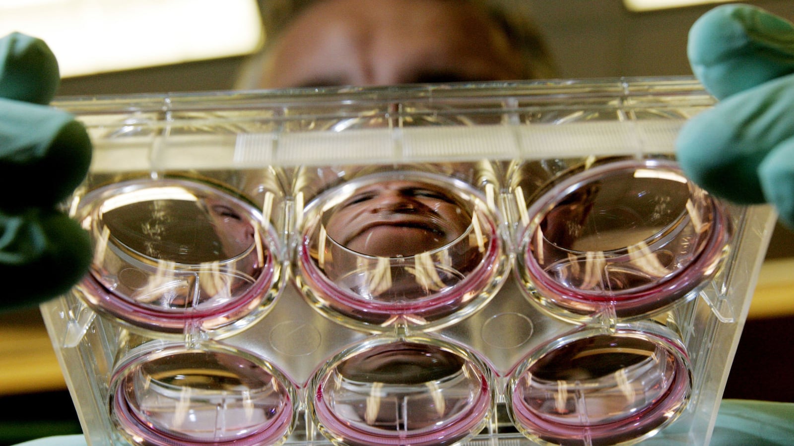 articles/2014/09/11/no-stem-cells-don-t-cause-autism/140910-sepkowits-autism-tease_swd87i