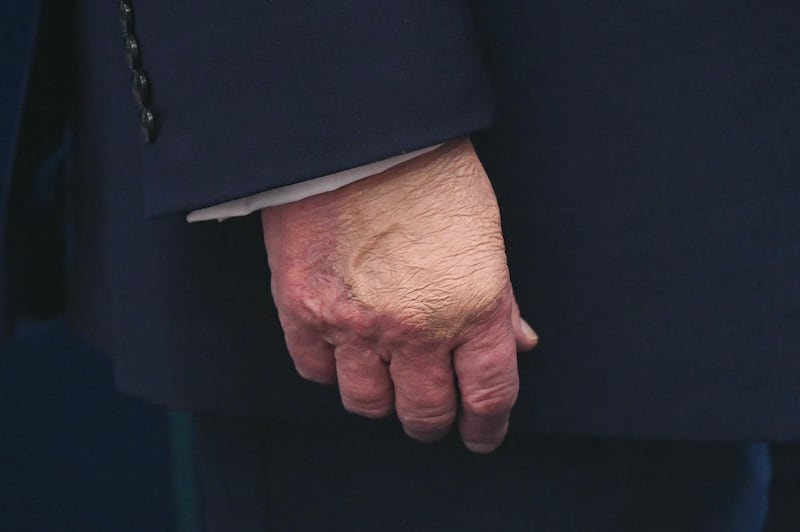 A detail of US President Donald Trump's hand is seen as he attends a press briefing in the James S. Brady Press Briefing Room of the White House on April 6, 2026, in Washington, DC.