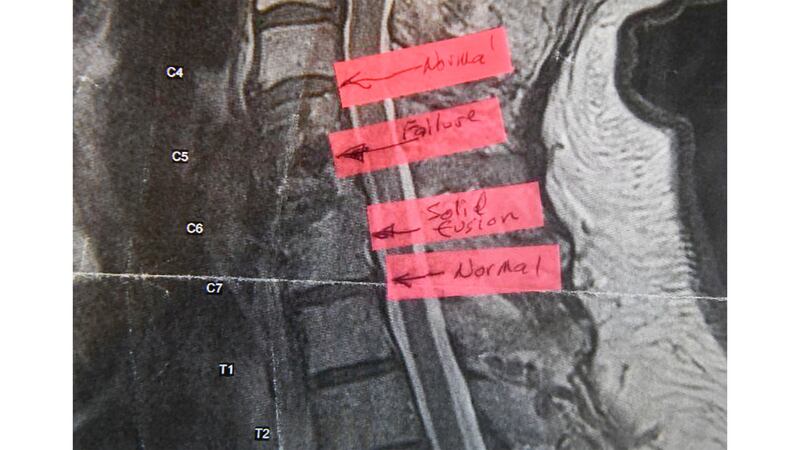 210806-KHN-implants-embed-03_o0fzsq