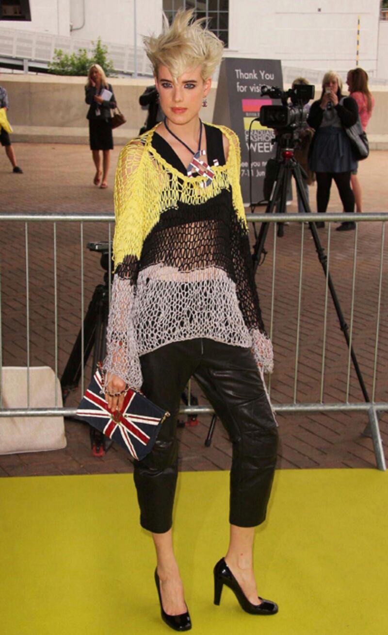 galleries/2012/08/02/pamela-anderson-jeff-holm-more-celebs-who-wear-there-s-something-about-mary-hair-photos/mary-hair-12_f03fs5