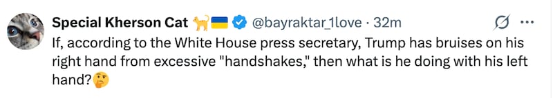 The White House has cited Trump's frequent "handshaking" as the cause of his bruising.
