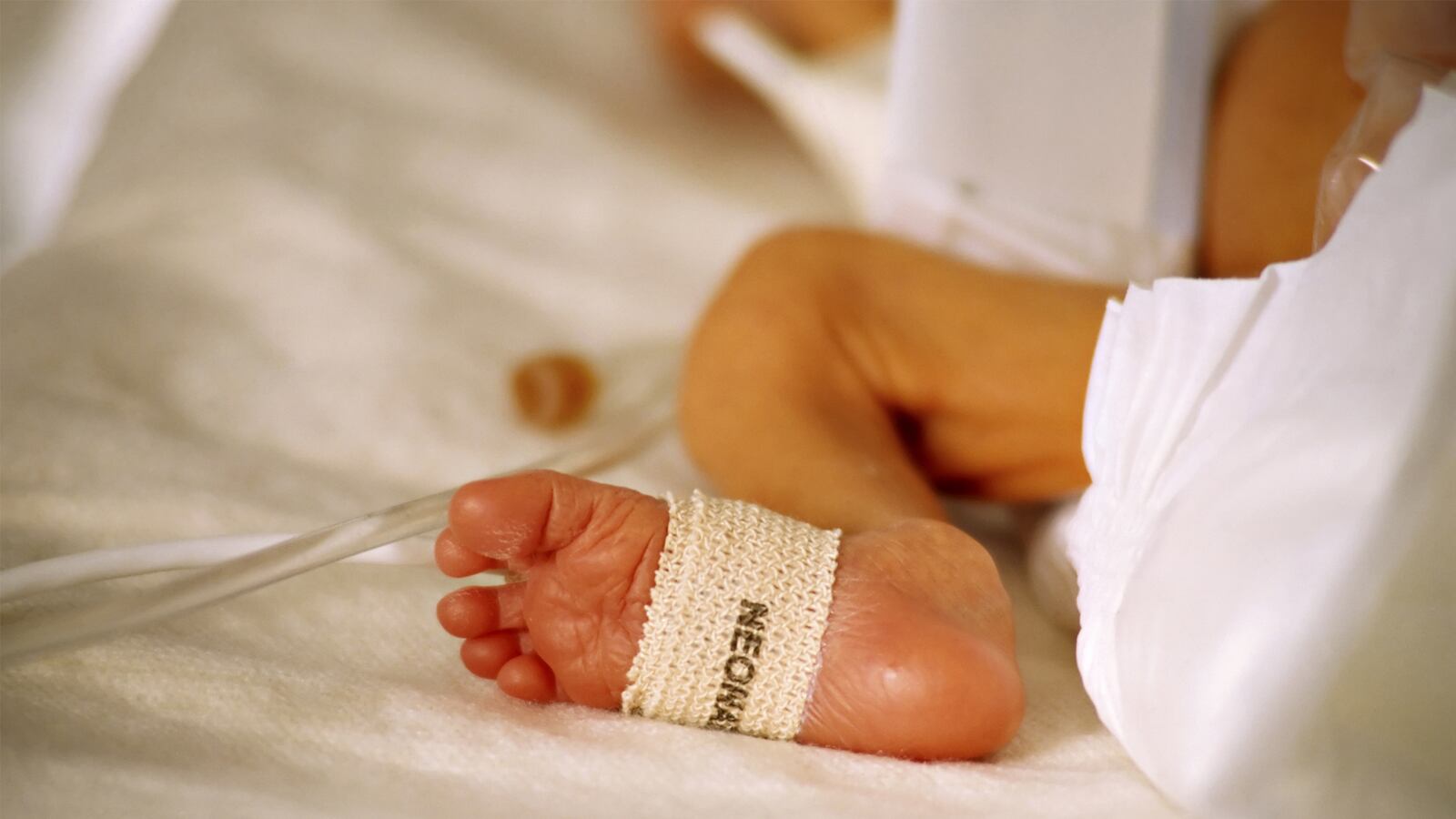 articles/2015/05/11/are-babies-really-viable-at-22-weeks/150508-perlman-premature-babies-tease_xukukf