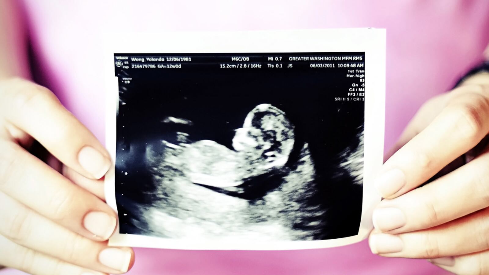 articles/2012/02/24/as-virginia-ultrasound-rule-fails-is-gop-seeing-reproductive-rights-backlash/virginia-ultrasound-law-goldberg_tg0gqk