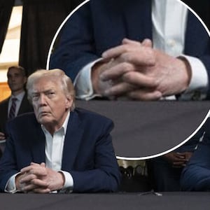 Donald Trump with inset of his hands