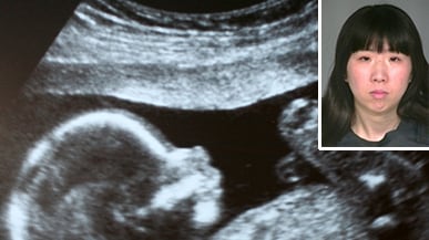 articles/2011/04/13/jennifer-block-on-bei-bei-shuais-feticide-ordeal/block-feticide_172882_g11pbr