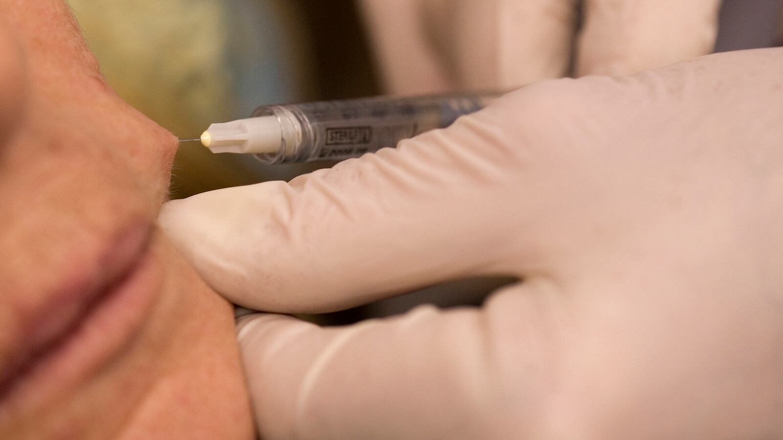 A cosmetic procedure