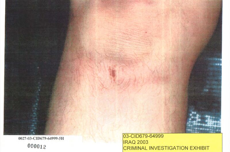 articles/2016/02/05/obama-s-pentagon-covers-up-bush-era-detainee-abuse/160205-shane-abuse-embed3_k5pxen