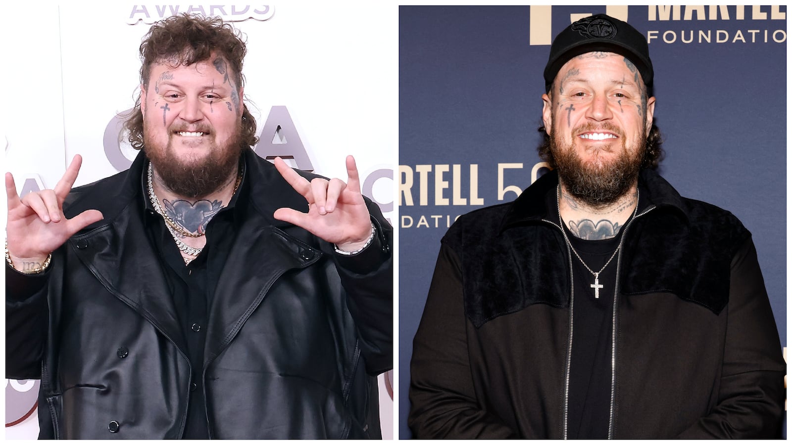 Jelly Roll in 2022 and 2025, during his weight loss journey.