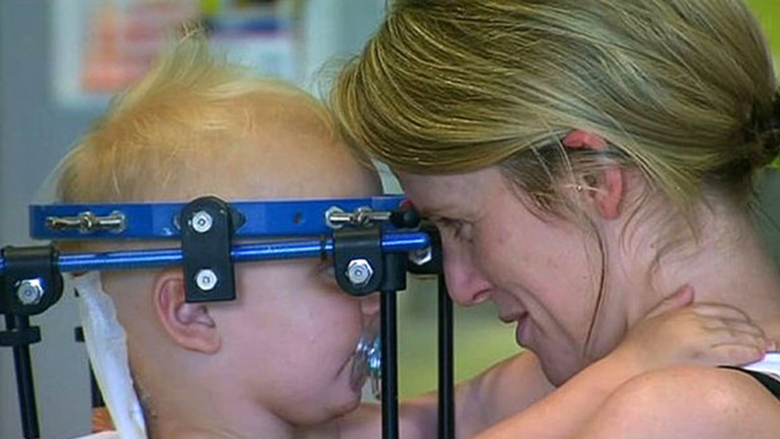 articles/2015/10/12/doctor-s-reattached-toddler-s-decapitated-head/151011-whittaker-baby-head-tease_zvzkw3