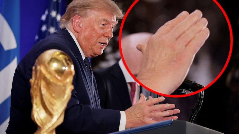 A close-up of Donald Trump's hand.