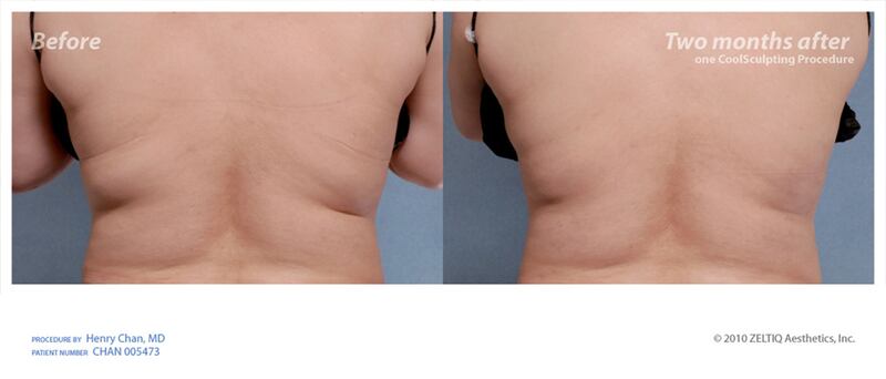 galleries/2010/11/27/cosmetic-procedures/cosmetic-procedures---fat-burning-machines_xnhue9