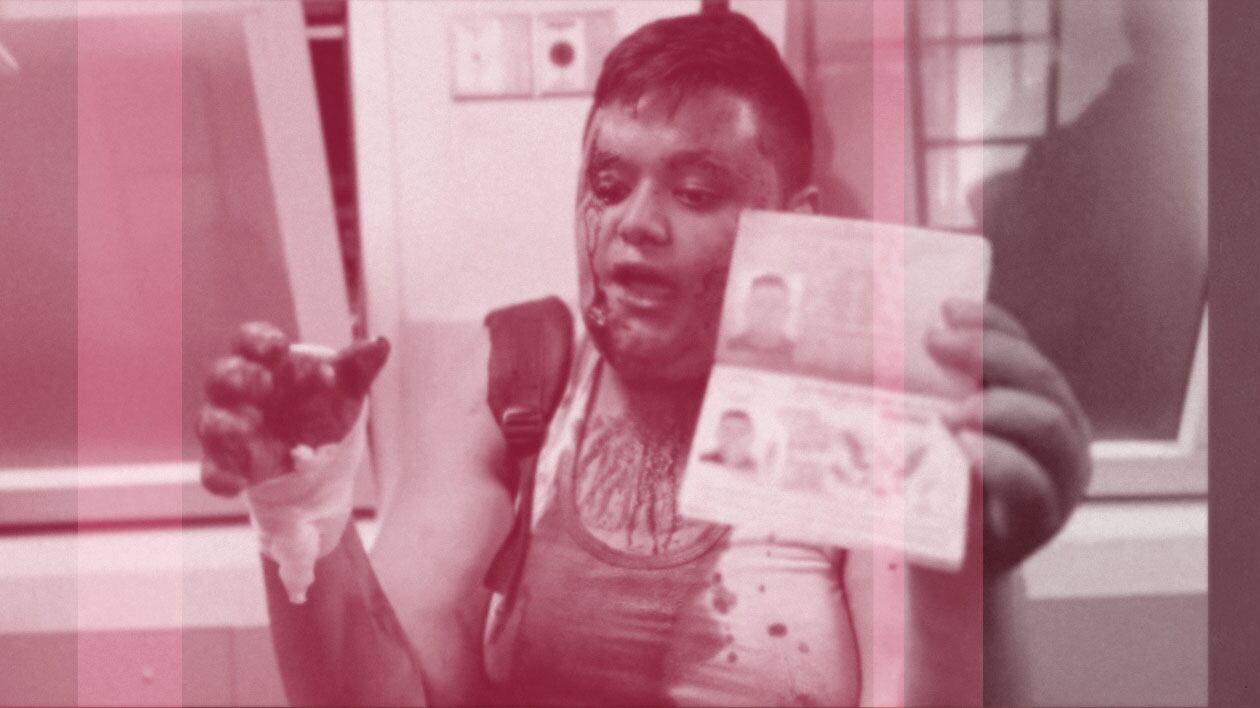 A photo illustration showing Yousof Abedalazeez Abushaban covered in blood after the death of his sister from an Israeli Airstrike.