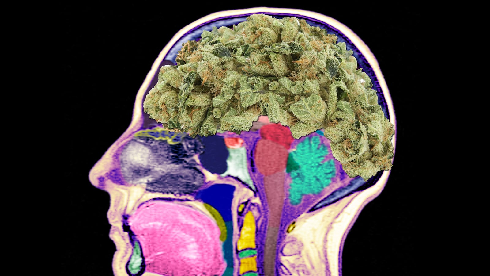 articles/2014/04/17/no-weed-won-t-rot-your-brain/140416-szalavitz-weed-brain-tease_ackrtz